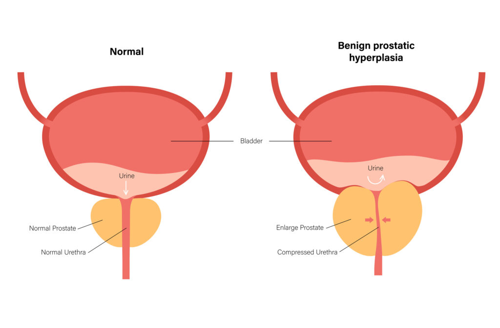 To Sit or to Stand – That is the Question - menMD